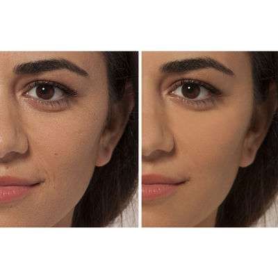 L'Oréal Paris True Match Kapatici 4N Beige - 5